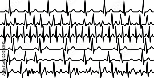 Konstfotografi Collection of electrocardiogram ECG heartbeat waveforms showing normal and abnor