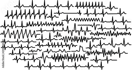 Bild auf Leinwand Comprehensive electrocardiogram ECG waveform collection featuring multiple cardi