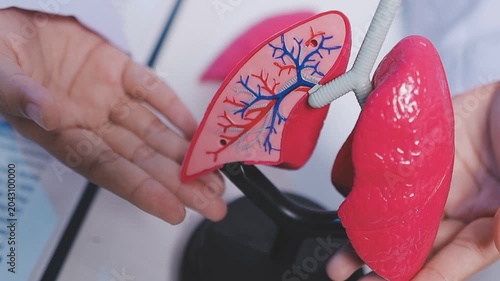 Pneumonia, lung cancer, Asian doctor holding human model.
