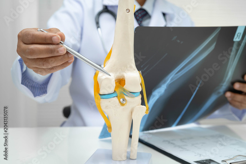 Doctor examining knee joint bone radiography xray film.