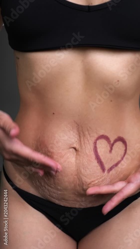 Close-up of a woman's postpartum belly with loose skin and a drawn heart