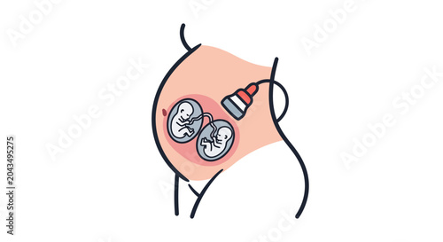 Twin Pregnancy Ultrasound: Two Babies in Womb with Sonogram Probe Illustration