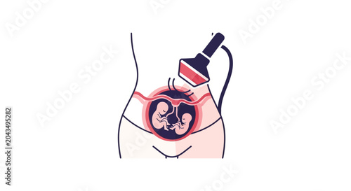 Twin Pregnancy Ultrasound: Two fetuses visualized in uterus during medical scan