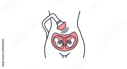 Twin Pregnancy Ultrasound: Two Babies in Womb, Medical Scan Illustration