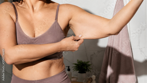 woman pinching skin on arm to show flabbiness. Body acceptance and natural beauty concept. Authentic female figure with loose skin after weight loss or aging. Wellness routine.