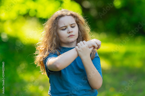 Εκτύπωση καμβά Skin irritation on child arm