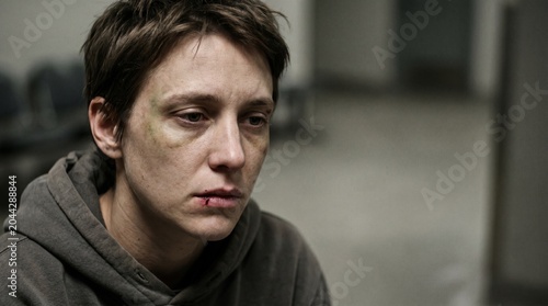 Close-up of an injured woman with a bruised eye and cut lip looking down in a bleak indoor setting, representing abuse or trauma.