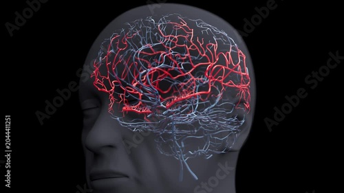 Middle cerebral arteries and branching blood vessels, animation