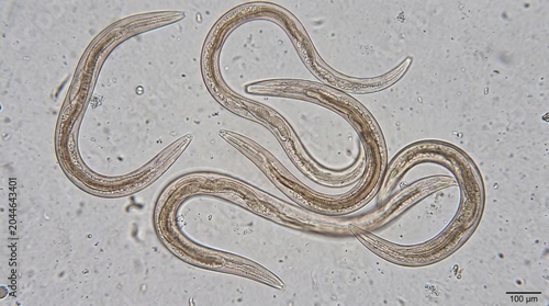 Microscopic view of nematodes, small parasitic worms, under a microscope.