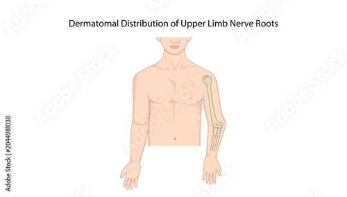 Tableau sur toile Dermatomal Distribution of Upper Limb Nerve Roots
sensory dermatome distribution of the upper limb and corresponding cervical spinal nerve root innervation