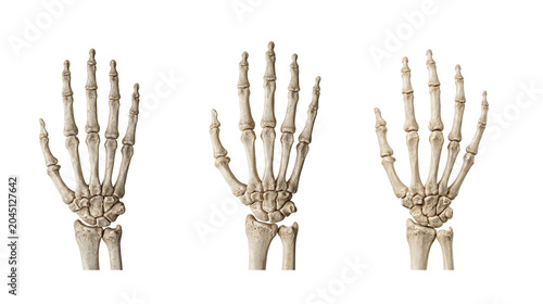 Three human hand skeletons showing skeletal anatomy against white background with skeleton skeletal research structure educational orthopedic clinical diagnostic radiology