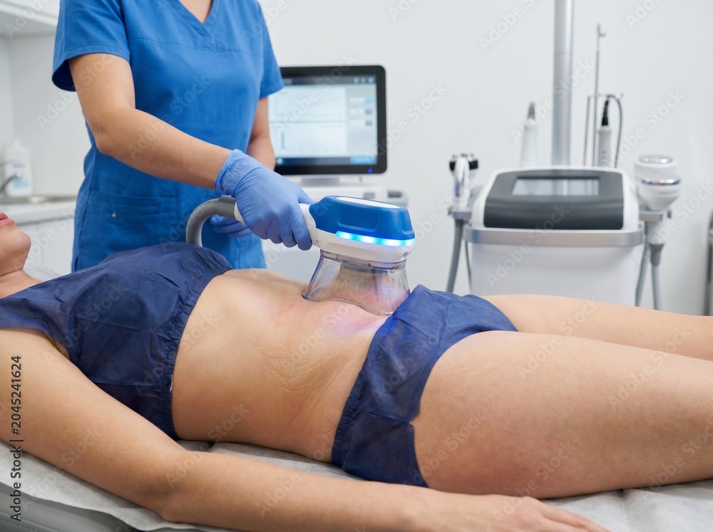 Obraz premium Medical Body Contouring Abdominal Fat Freezing Cryolipolysis Aesthetic Dermatology Procedure Close-Up