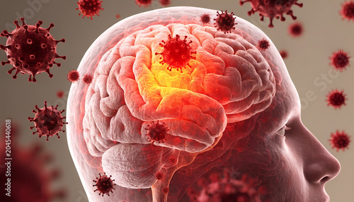 3D Anatomy Illustration Brain Infection and Viral Disease Concept Illustration