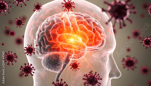 3D Anatomy Illustration Brain Infection and Viral Disease Concept Illustration