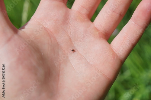 Tableau sur toile Macro shot of a tiny parasitic tick on skin of human hand