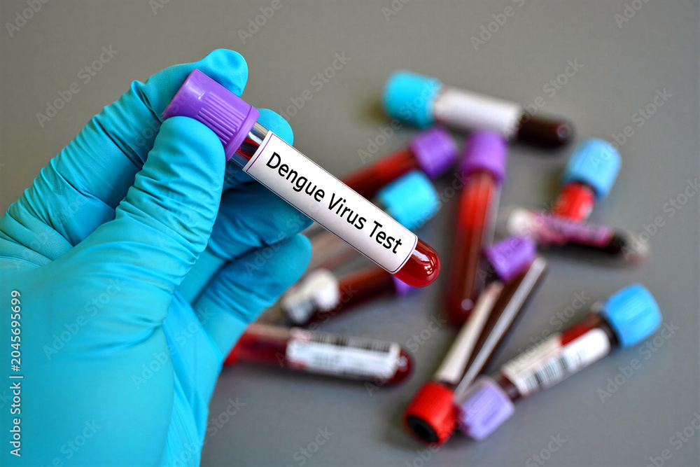 Obraz premium Medical professional holding a dengue virus test tube with blood samples for diagnosis