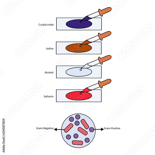Bild auf Leinwand Gram staining procedure in microbiology laboratory, crystal violet, iodine, alco