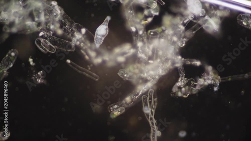 Tiny aquatic creatures observed with detailed microscopy