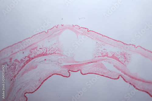 Foto Human Finger Longitudinal Section Nail Skin Bone Histology S