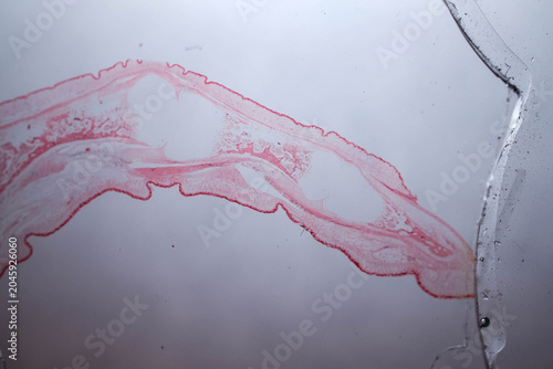 Fotografie Human Finger Longitudinal Section Nail Skin Bone Histology S