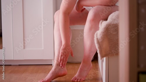 Close Up of Middle Aged Woman Applying Cream to Leg with Visible Varicose Veins and Spider Veins at Home