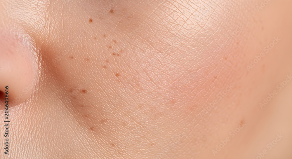 Fototapeta premium Close-up of a person's face with freckles on their cheek and nose