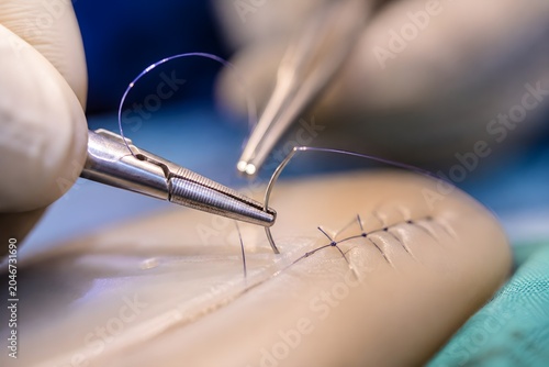 Surgeon Suturing Wound With Needle Driver — Close-Up Surgical Stitching Medical Photography