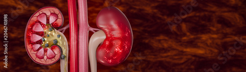 Tableau sur toile Kidney health deterioration linked to fast food, sugary beverages, alcohol, and processed meals causing chronic renal stress and urinary system damage