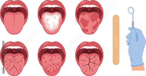 Photos Tongue Disease and Oral Health Symptoms Collection with Infections Inflammation