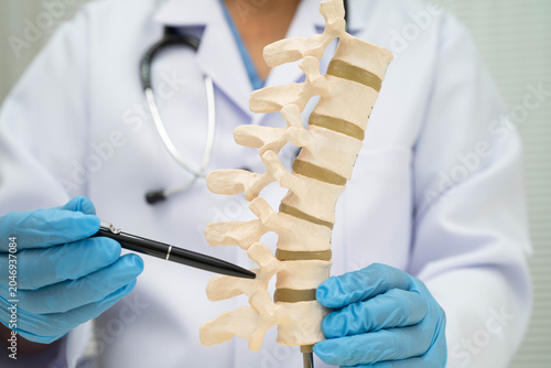 Photography Asian doctor holding spinal nerve and bone model, Lumbar spine displaced herniated disc fragment for treatment medical in the orthopedic department