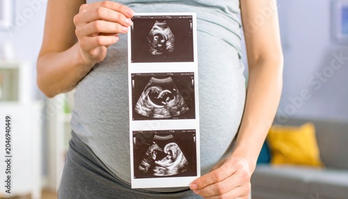 Pregnant Woman Holding Ultrasound Images.