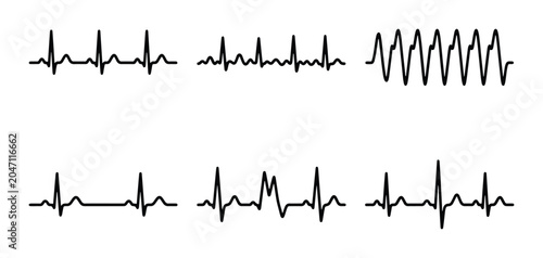 Tableau sur toile ECG Heartbeat Line Graphics, Medical EKG Pulse Waveforms, Cardiology Health Moni