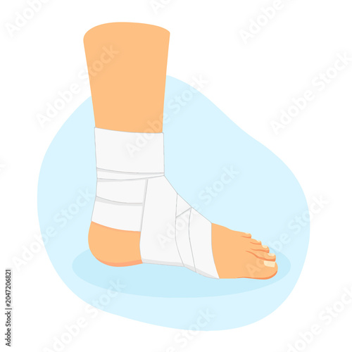 bandaged leg sprain