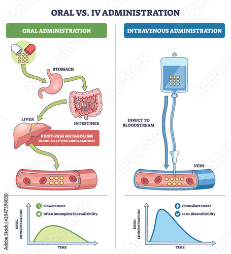 Canvas Print Oral vs IV drug administration pathways showing onset and bioavailability, pills, IV line, and liver illustrate first-pass vs direct bloodstream delivery