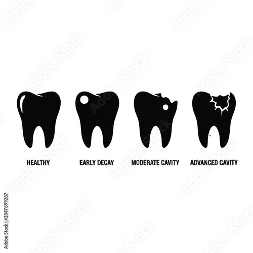 Obraz na plátně Tooth decay progression stages from healthy to cavity icon.