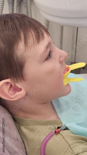 Child patient with dental impression tray in mouth during orthodontist visit. Orthodontic treatment and oral health examination. Dental checkup procedure in clinic for healthy smile.