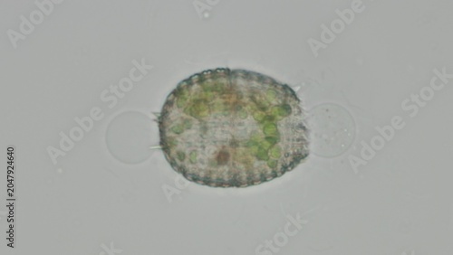 Fotografía Coleps sp. ciliate at 50x under brightfield microscopy