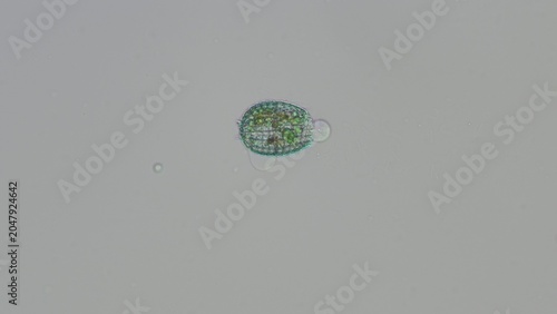 Photos Coleps sp. ciliate and debris at 20x brightfield microscopy