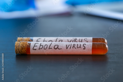 Obraz na plátně ebola virus test tubes background journal table surface close up of blood sample