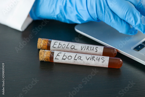 Canvastavla close up view of two glass test tubes labeled ebola virus filled with blood samp