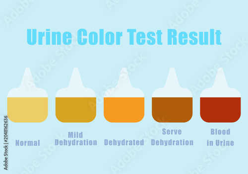 Urine Color Test Result Background.