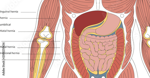 Schilderij op canvas Human anatomy, muscle and skeletal system, hernias, medical illustration, vector