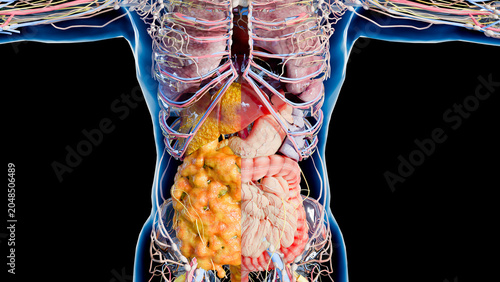 Progressive Accumulation of Visceral Fat and Fatty Liver Disease, Metabolic Syndrome and Internal Fat Gain, Liver and Abdominal Fat Progression, Advanced Steatosis and Visceral Obesity, 3d render