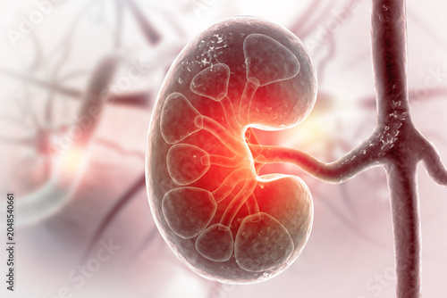 Chronic Kidney Disease. Medical organ. Cross section. 3d illustration