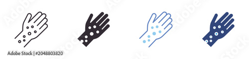 Photos Skin Allergy Icon Set, hand rash, dermatitis, allergic symptoms, medical vector