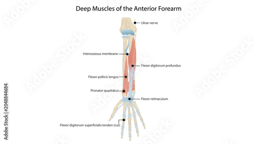 Tableau sur toile Deep Muscles of the Anterior Forearm, the deep flexor muscles of the anterior forearm, including flexor digitorum profundus, flexor pollicis longus, and pronator quadratus