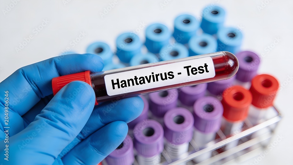 Fototapeta premium Medical professional wearing blue latex gloves holds a glass test tube containing human blood sample labeled hantavirus test in a bright clinical laboratory setting today