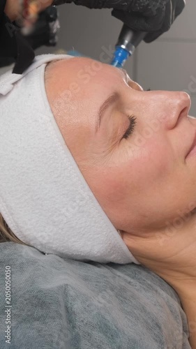 Professional cosmetologist performing a fractional mesotherapy procedure on a woman's face