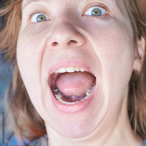 Tableau sur toile Close Up Adult Female Screaming With Wide Open Mouth Eyes Looking Upward Revealing Tongue Teeth And Detailed Facial Skin Texture In Square Portrait Framing