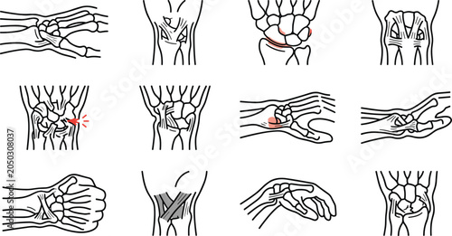 Foto Anatomical diagrams of human wrist bones and ligaments showing various clinical perspectives